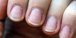 Damaged nails: what routine to adopt?